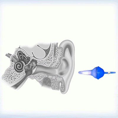 Innovativa uppblåsbara öronproppar