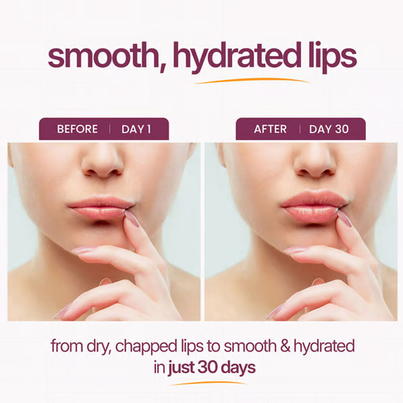 Vitamin Hud Kalcium Jon Øyekrem