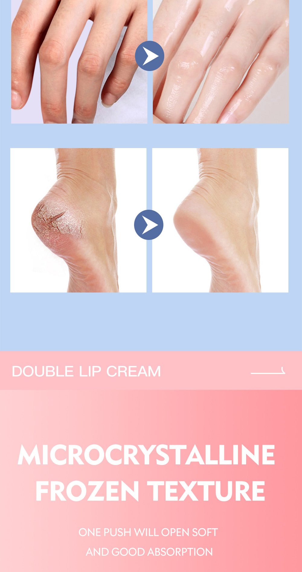 🔥 🔥 Fotvårdskräm,Anti Cracked Foot Cream,Återfuktande,Anti Crack,Mjukgörande och vårdande kräm för torra,spruckna fötter,Avlägsnar död hud och återfuktar torr hud