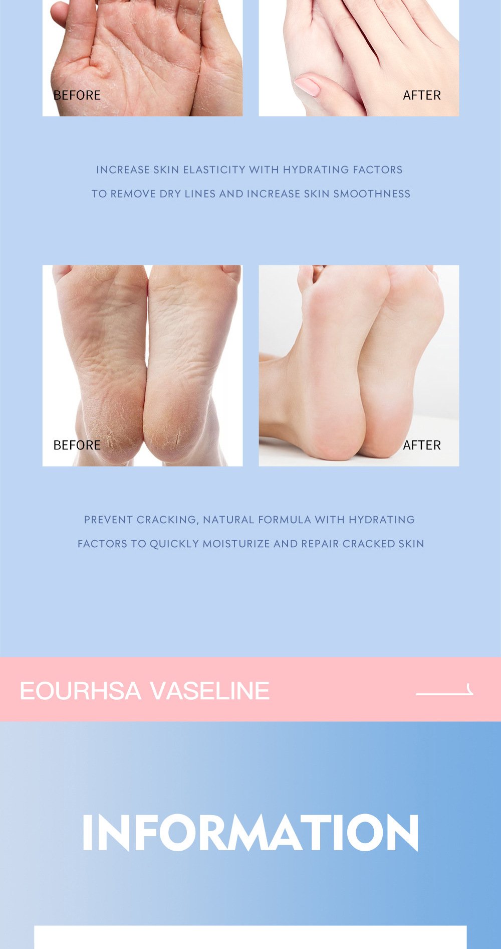 🔥 🔥 Fotvårdskräm,Anti Cracked Foot Cream,Återfuktande,Anti Crack,Mjukgörande och vårdande kräm för torra,spruckna fötter,Avlägsnar död hud och återfuktar torr hud