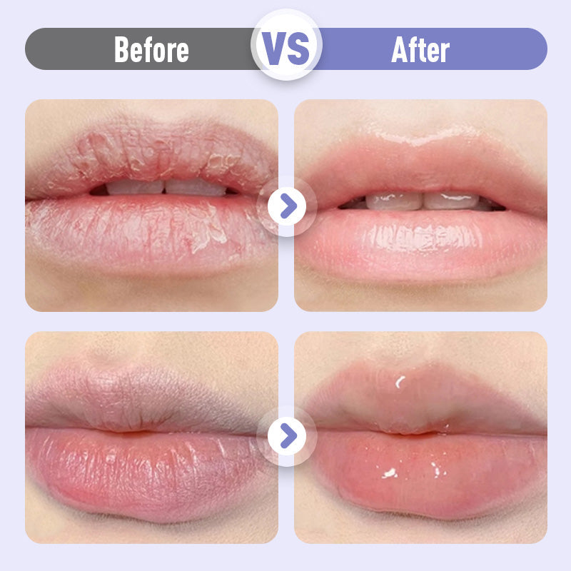 👑Återfuktande läppserum som ger fyllighet och motverkar rynkor💋